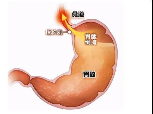 山西肛泰肛肠医院：腹胀、嗳气、反酸、胃口差消化不好？