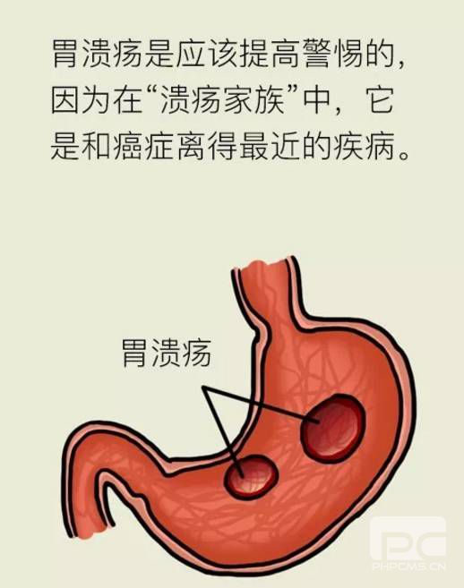 山西肛泰肛肠医院：小心，胃溃疡离癌症最近！