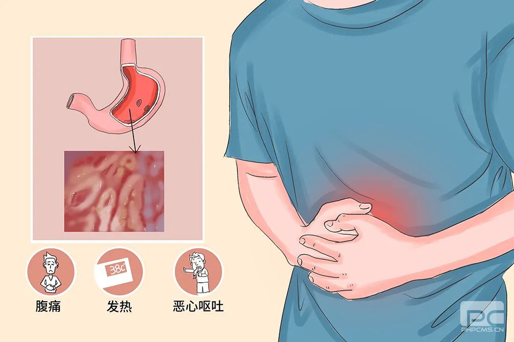 山西肛泰肛肠医院：急性胃炎的症状危害有哪些呢？