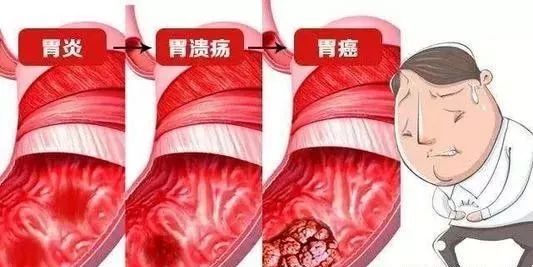 山西肛泰肛肠医院：得了胃溃疡的危害有什么