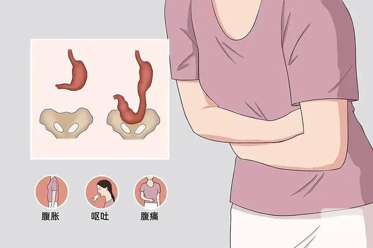 山西肛泰肛肠医院：胃下垂的症状有哪些？