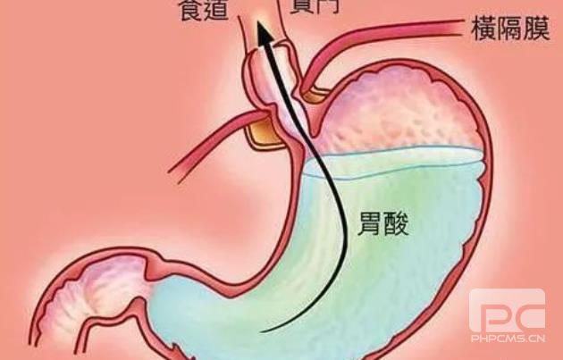 山西肛泰肛肠医院：胃酸过多怎么办？有哪些饮食禁忌？