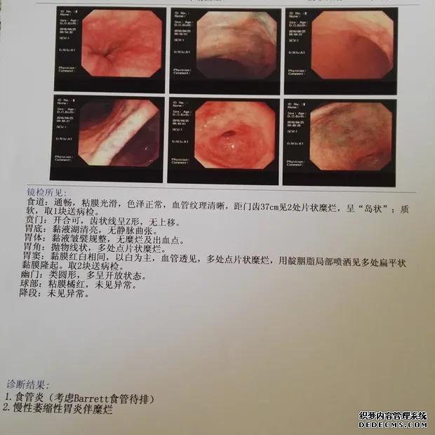 山西肛泰肛肠医院：萎缩性胃炎离胃癌不远了？