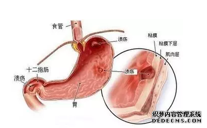 山西肛泰肛肠医院：胃胀、胃酸这些胃肠疾病症状你有吗？