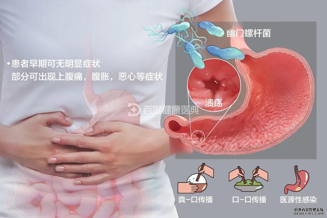山西肛泰肛肠医院：根除幽门螺杆菌，很伤身体吗？